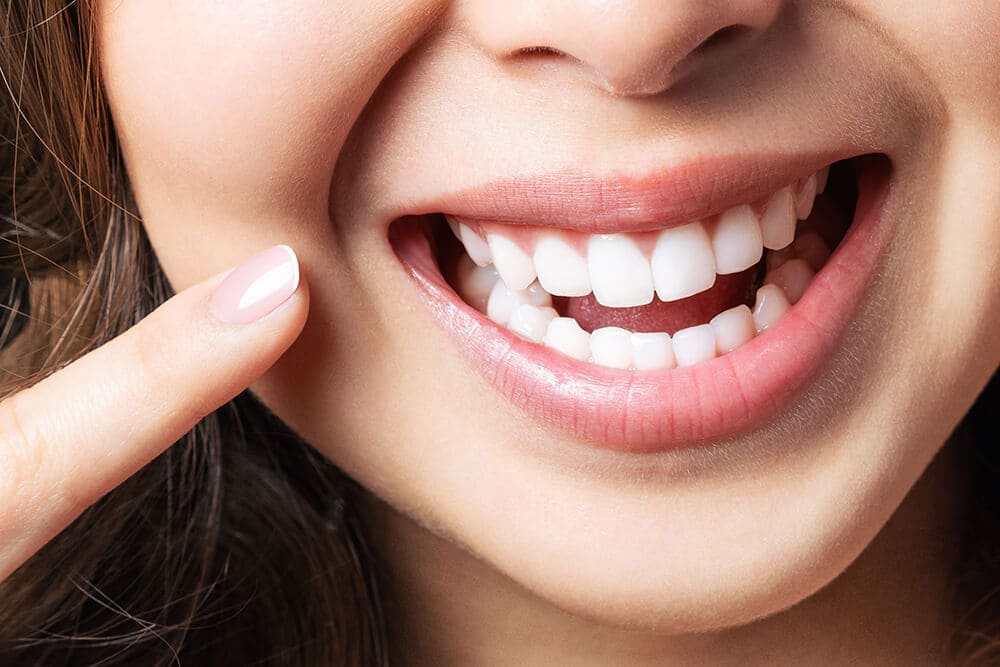 Swiper-Foto für: Veneers.Eine Nahaufnahme des Lächelns einer Person.
